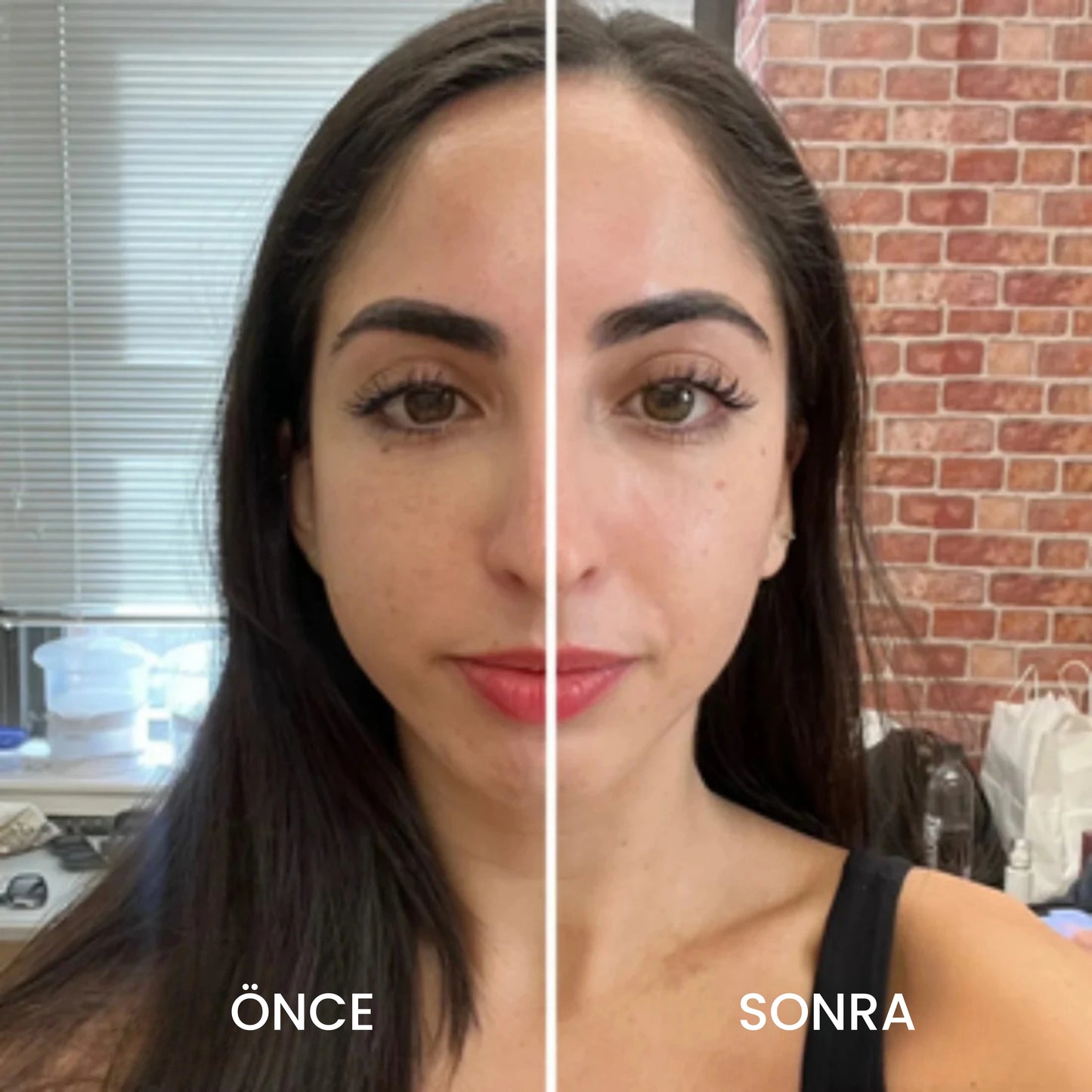 Velya™ Lenfatik Yüz Fırçası